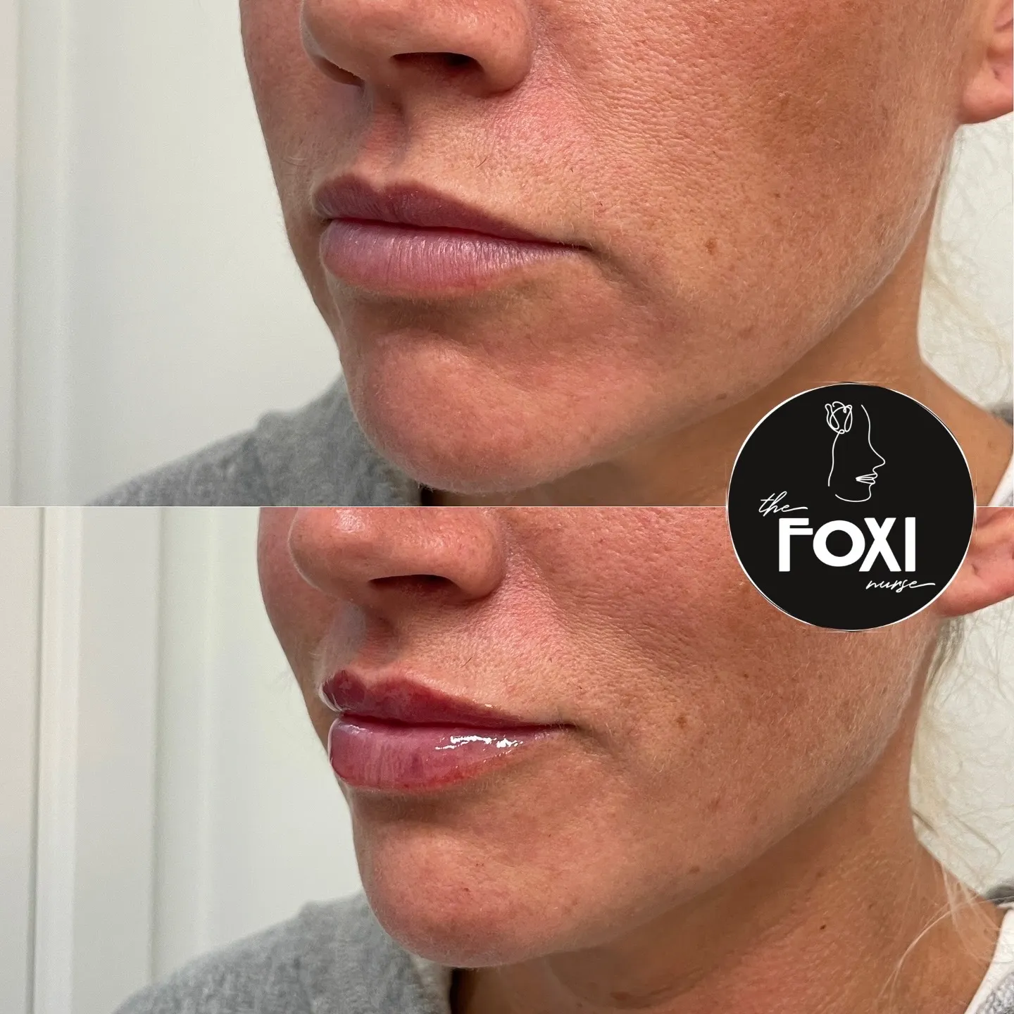 Clean, professional medical spa treatment room with neutral tones at The Foxi Nurse in Roseville
