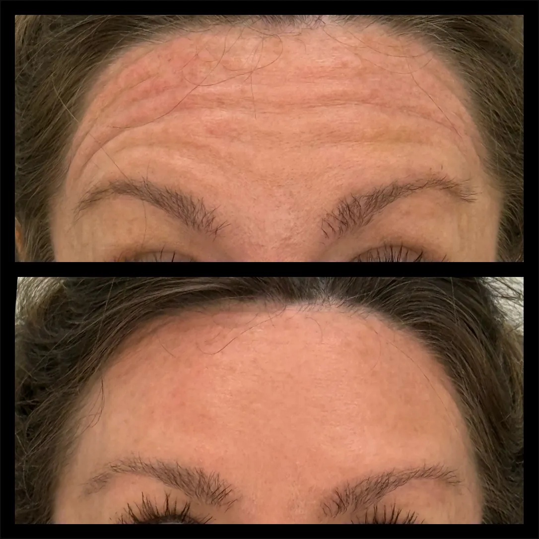 Clean, professional medical spa treatment room with neutral tones at Eleve Aesthetics in Morton